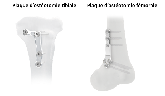 plaques Intrauma